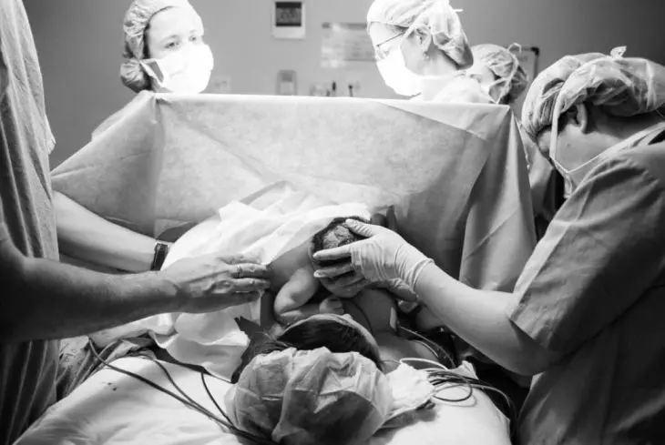 Relato de cesárea necessária durante indução de parto