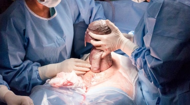 Relato de uma cesárea humanizada: Nascimento do Daniel