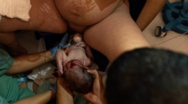 Relato de parto humanizado: Nascimento da Nina